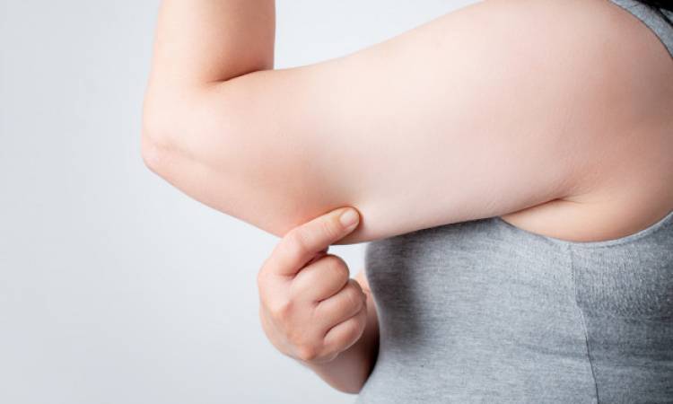 Before and After Arm Brachioplasty: Key Considerations for a Successful Procedure