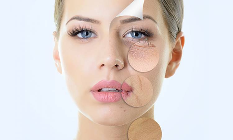 Review căng da mặt bằng chỉ collagen có thật sự hiệu quả như lời đồn