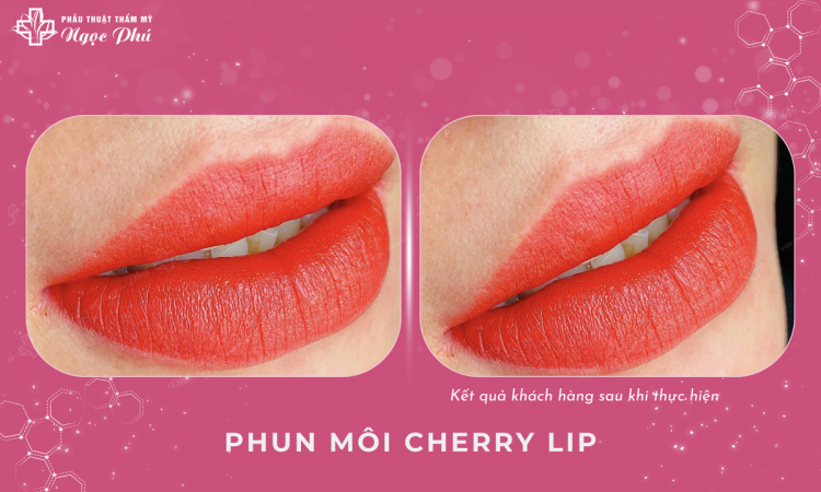 Phun môi Cherry Lip