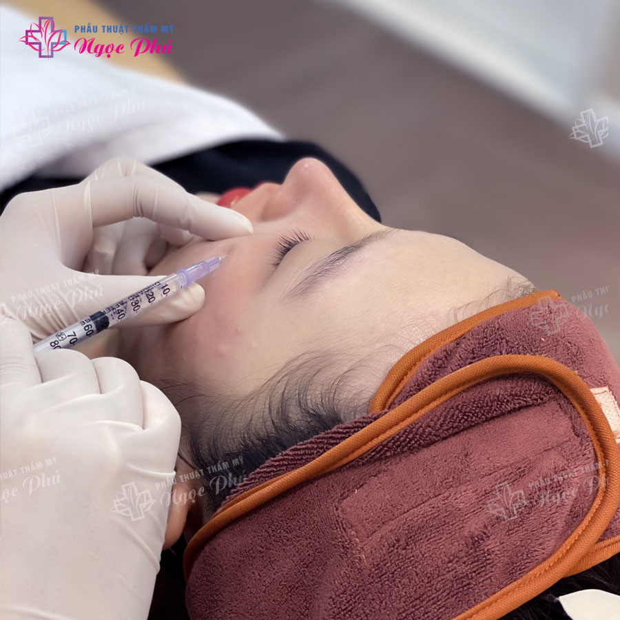 Cách chăm sóc da sau tiêm Meso là một bước quan trọng giúp da phục hồi nhanh chóng và nâng cao hiệu quả trẻ hóa.