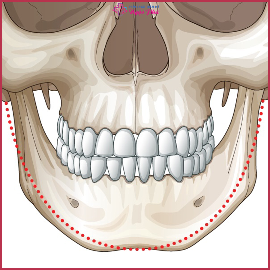 Phẫu thuật gọt xương hàm được biết đến là dịch vụ thẩm mỹ làm thay đổi cấu trúc khuôn mặt thành V-line hoàn hảo nhất. 