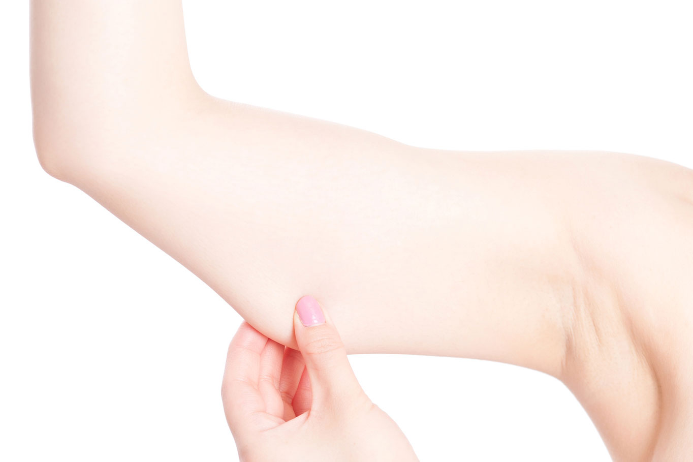 Hút mỡ bắp tay là một thủ thuật xâm lấn, vì vậy cần có thời gian để cơ thể hồi phục.