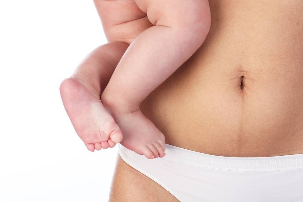 Hút mỡ bụng sau sinh là phương pháp thẩm mỹ sử dụng công nghệ hiện đại để loại bỏ lượng mỡ thừa tích tụ ở vùng bụng, giúp thon gọn vòng eo hiệu quả.