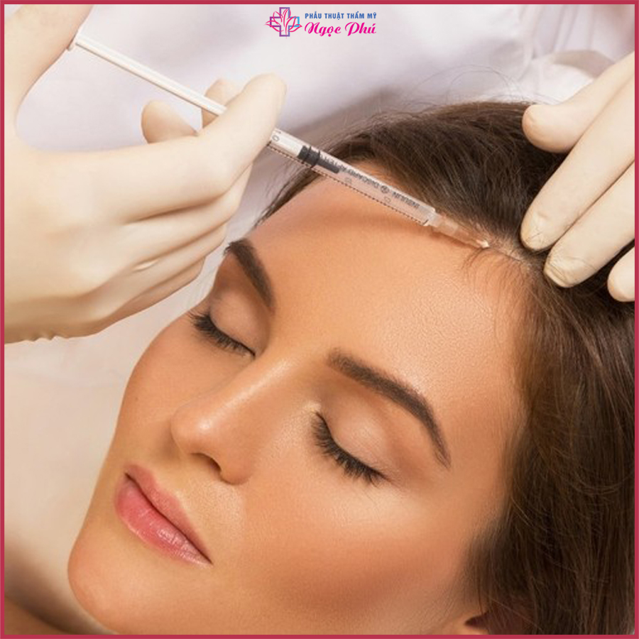 Meso Hair được biết đến là phương pháp được chỉ định để ngăn ngừa rụng tóc.