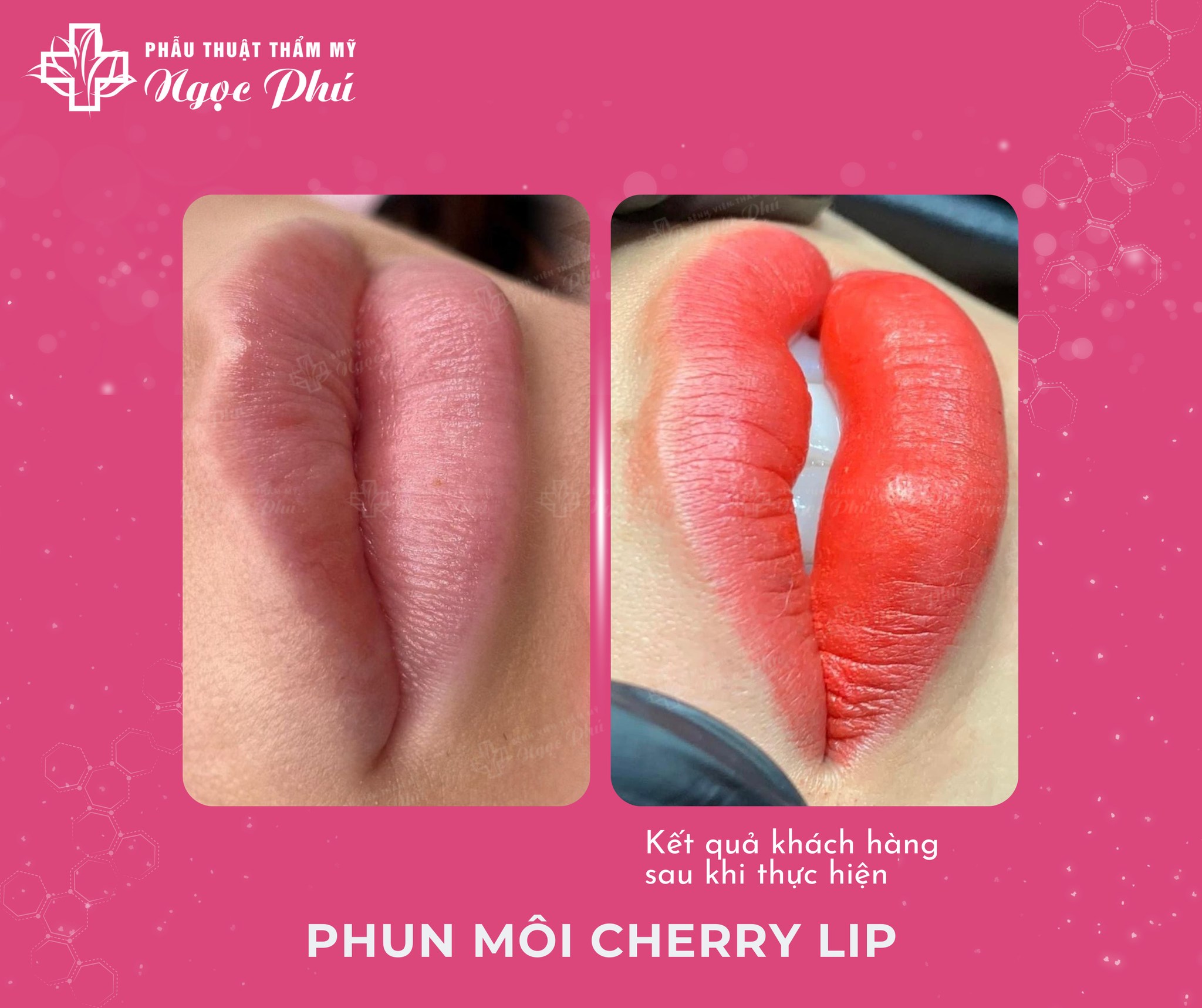 Phun môi Cherry Lip