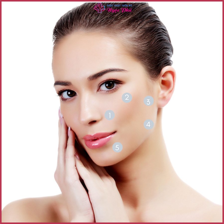 Phương pháp tiêm BAP 5 điểm được thực hiện bằng cách: Đưa chất xúc tác vào bên trong da thông qua 5 điểm trên khuôn mặt.