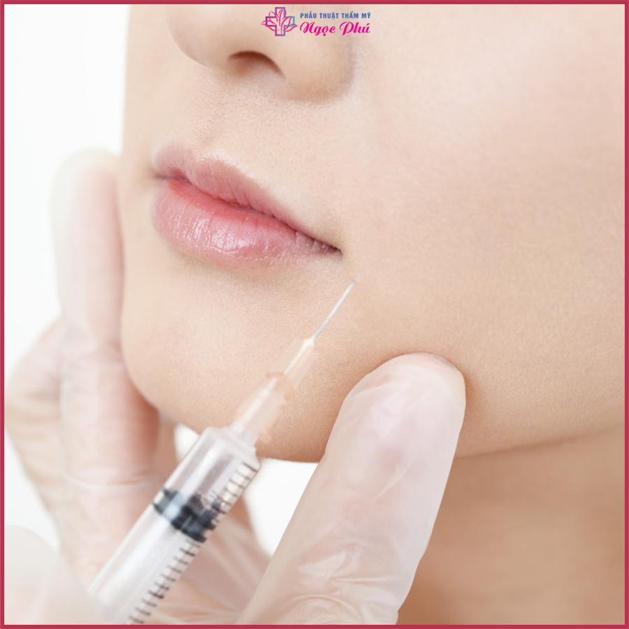quá trình tiêm Meso Botox  kết hợp giữa các thành phần tiêu biểu như HA kết hợp với một số dưỡng chất khác.