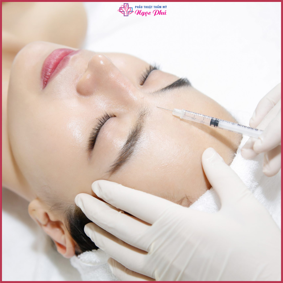 Meso Botox bổ sung các dưỡng chất cần thiết, tiêu biểu là HA (Dưỡng chất cần thiết cho da sau tuổi 30).